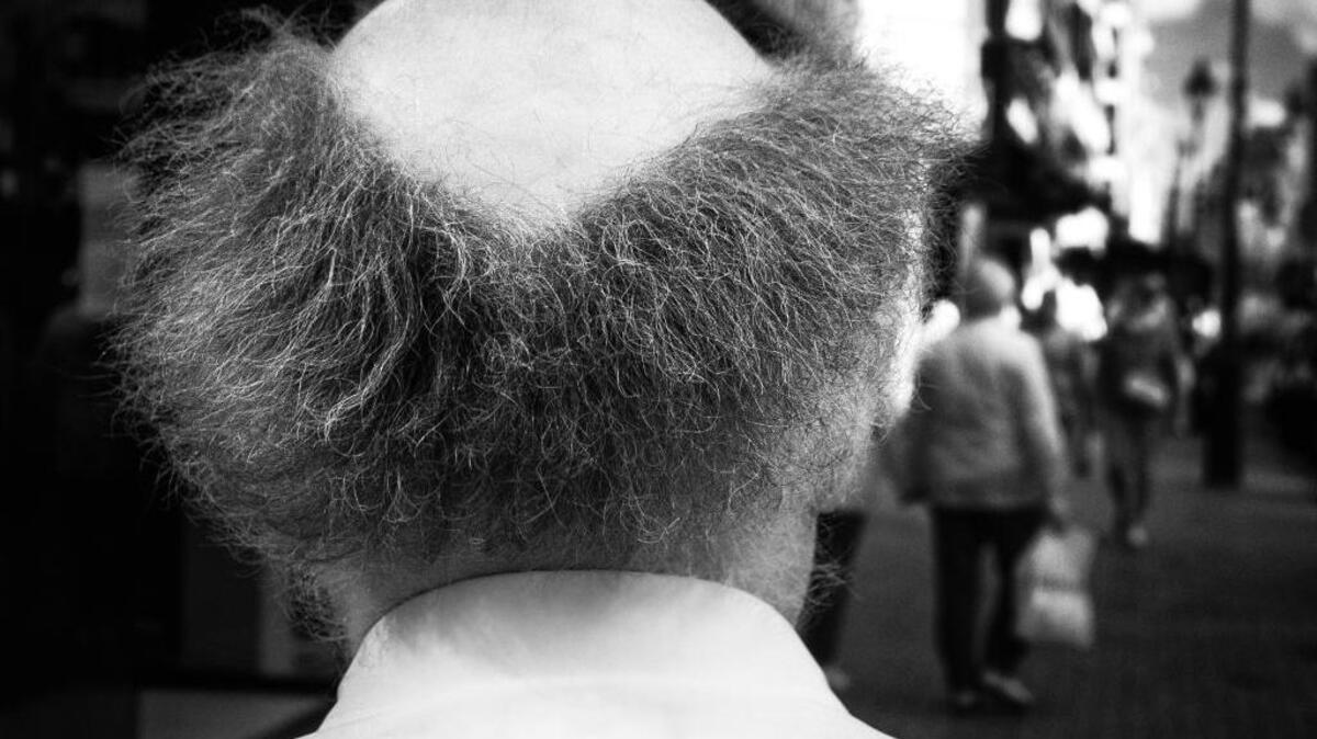 Maurice Warniers’ photograph “Bald Man.”