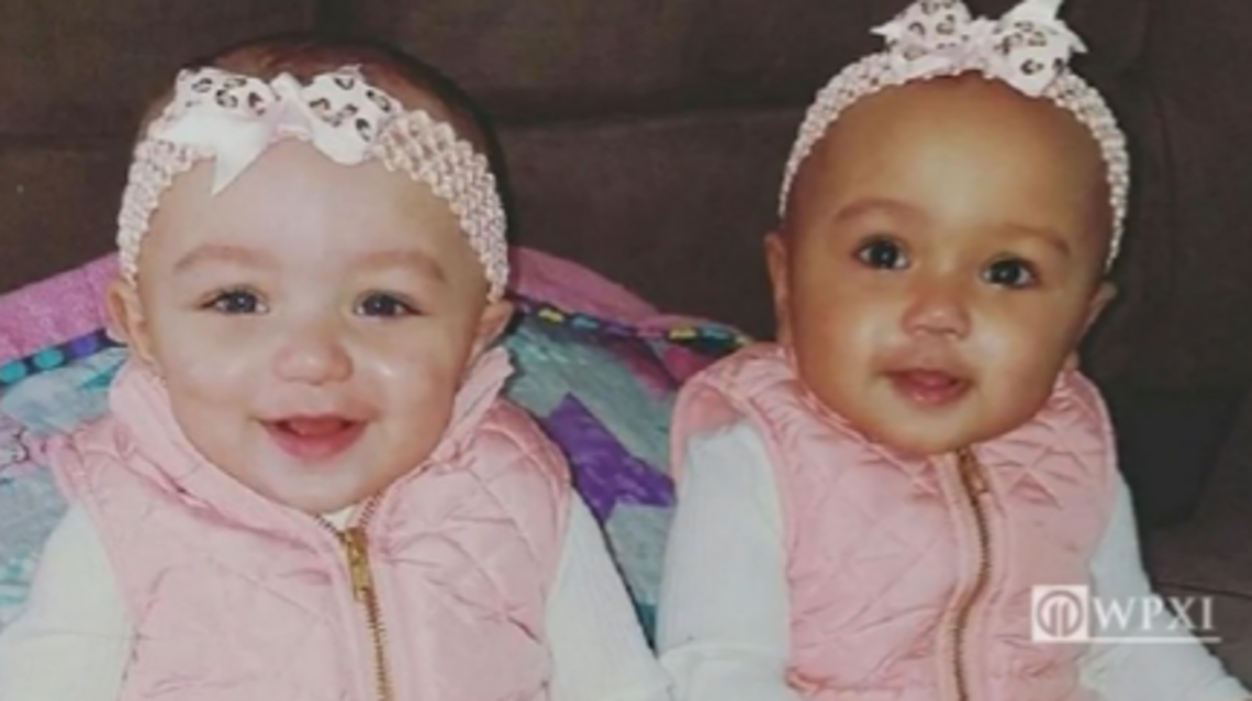 Twin baby girls born with different skin colors