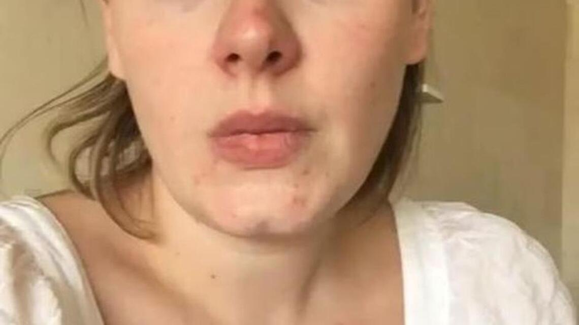 A sick Adele cancels Phoenix concert in Instagram video (watch)