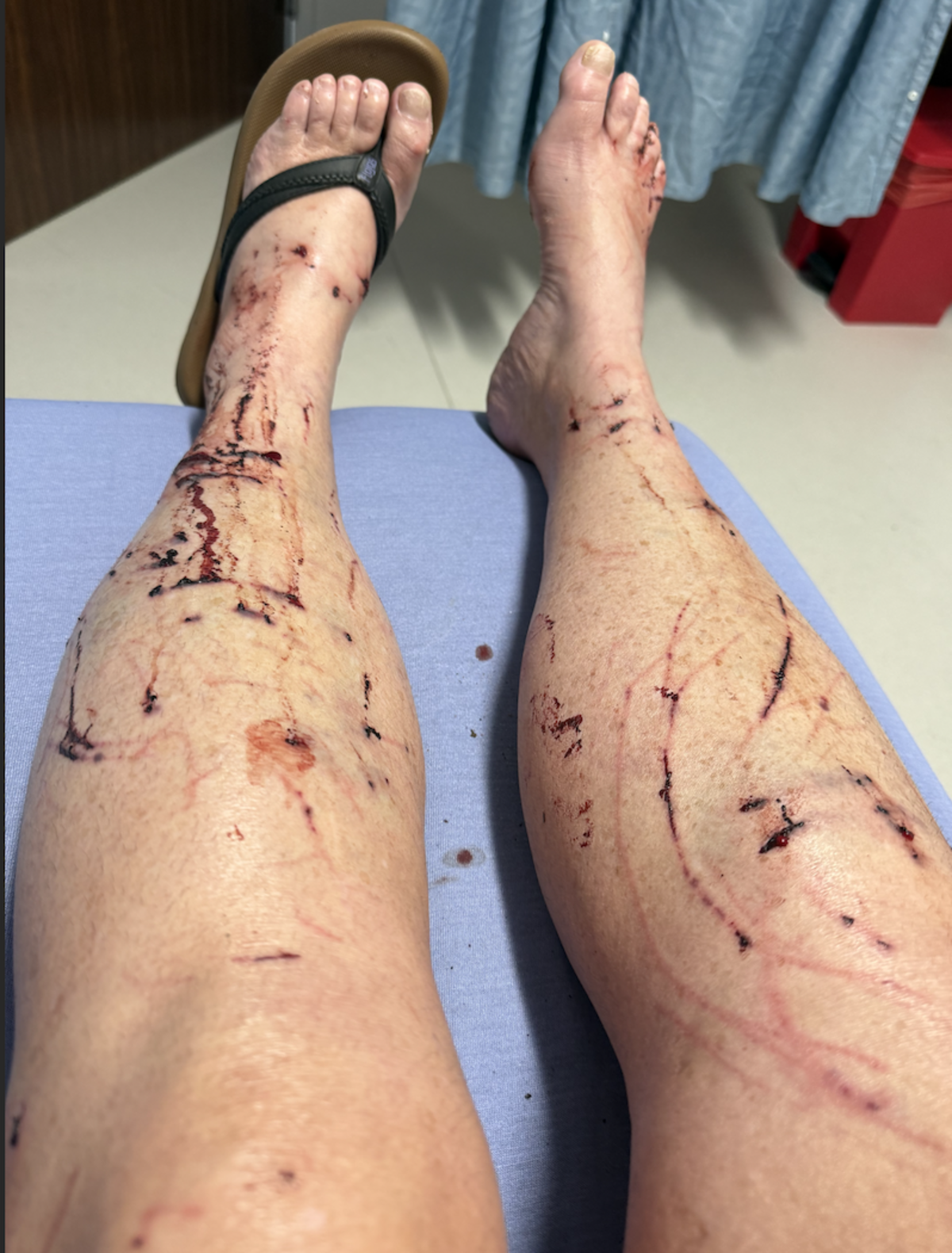 Lynnette Bellin of Reno, Nev., was attacked by a wild North American river otter during a morning swim in Lake Tahoe on Sunday, Aug. 30. The encounter left her with wounds on her feet, legs, hands and face, requiring 38 stitches.