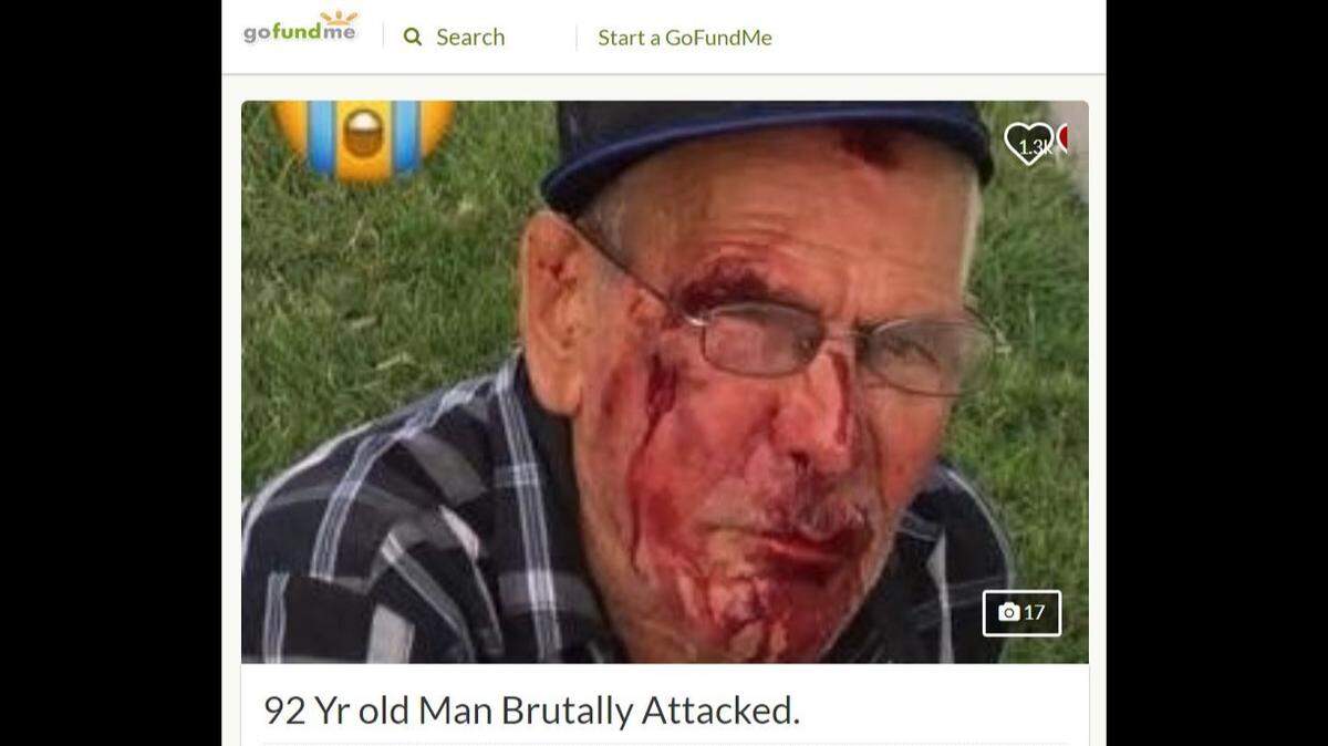 Rodolfo Rodriguez, 92, was kicked and beaten with a brick by attackers who told him to “go back to your own country” on July 4 in Los Angeles after he bumped into a child on his daily walk, police say. His family has established a GoFundMe account to help pay his medical bills.