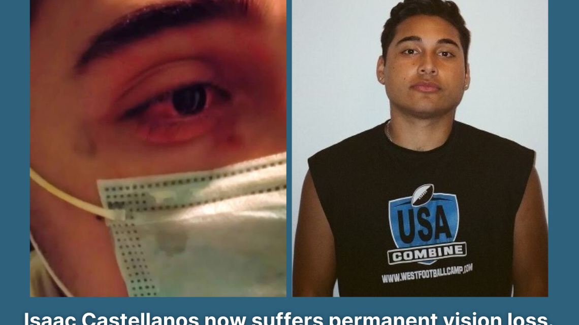 The 22-year-old was a senior in college when he was struck in the eye, the lawsuit says.