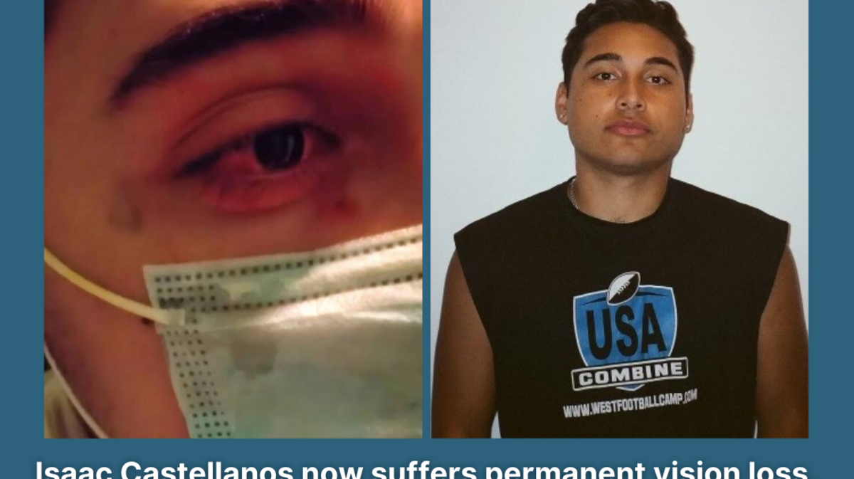 The 22-year-old was a senior in college when he was struck in the eye, the lawsuit says.