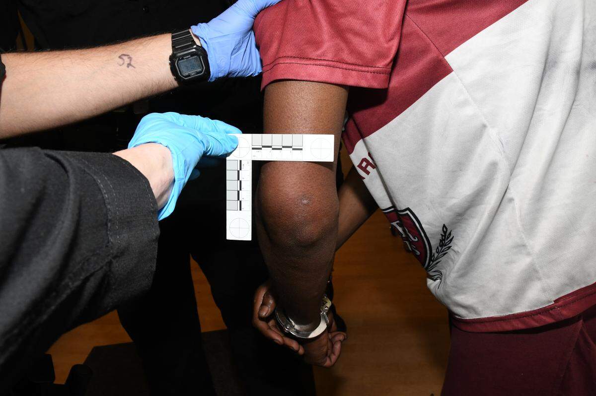 Officers observe an unidentified man’s elbow after the man was allegedly injured by law enforcement while in custody at the Sacramento County Main Jail.