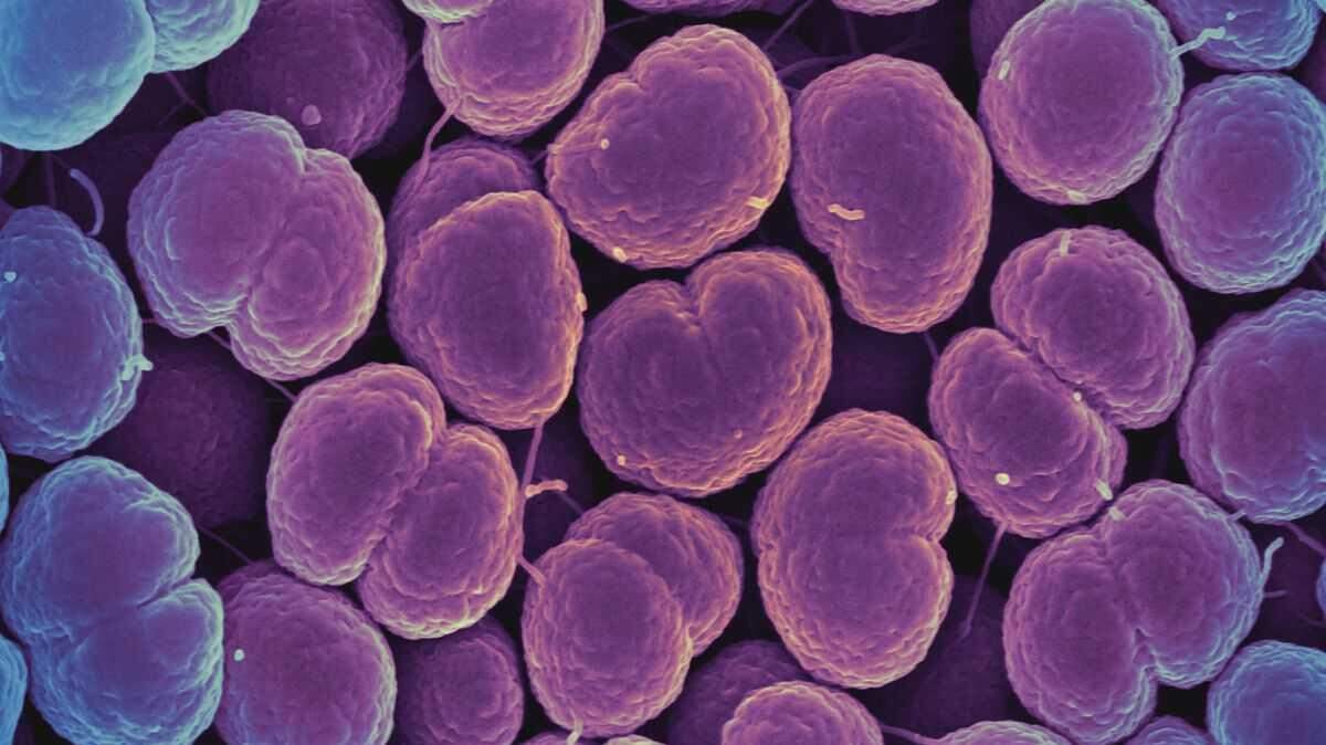 Several notable cities in Pennsylvania have emerged as hot spots for sexually transmitted diseases like gonorrhea, which is caused by the bacteria pictured and enlarged above.
