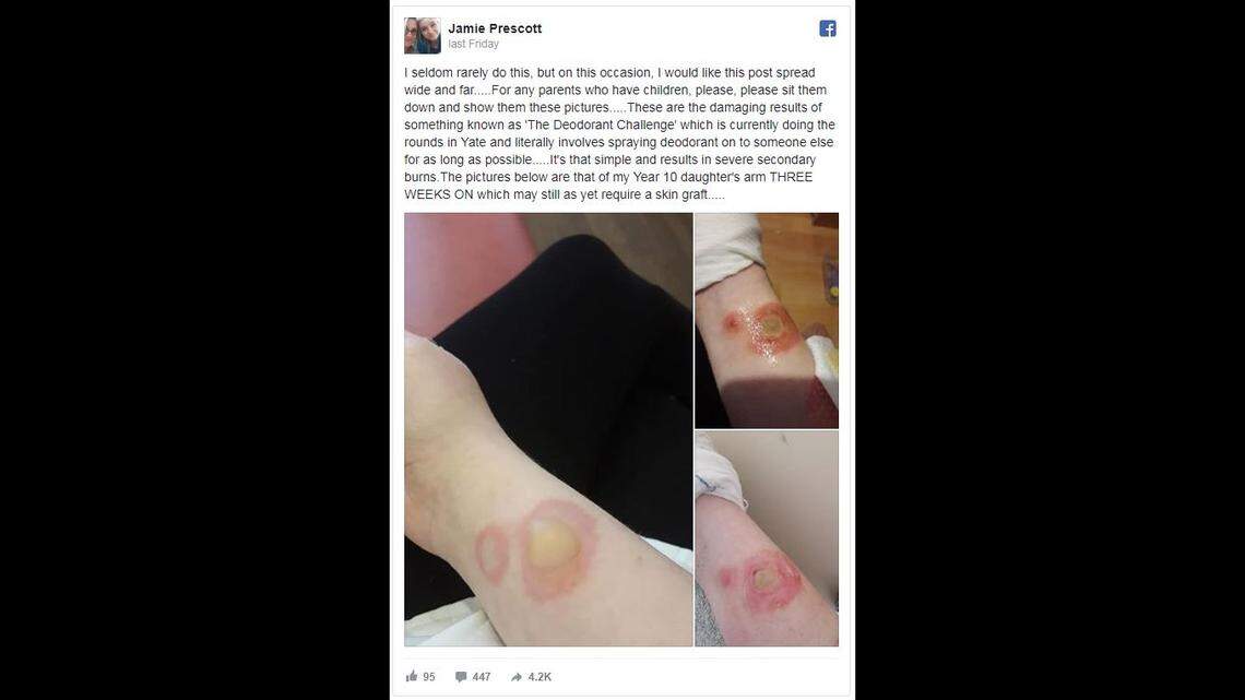 A Facebook post by a mom in England warning of the "deodorant challenge" has sounded the alarm about an online trend reportedly making the rounds.