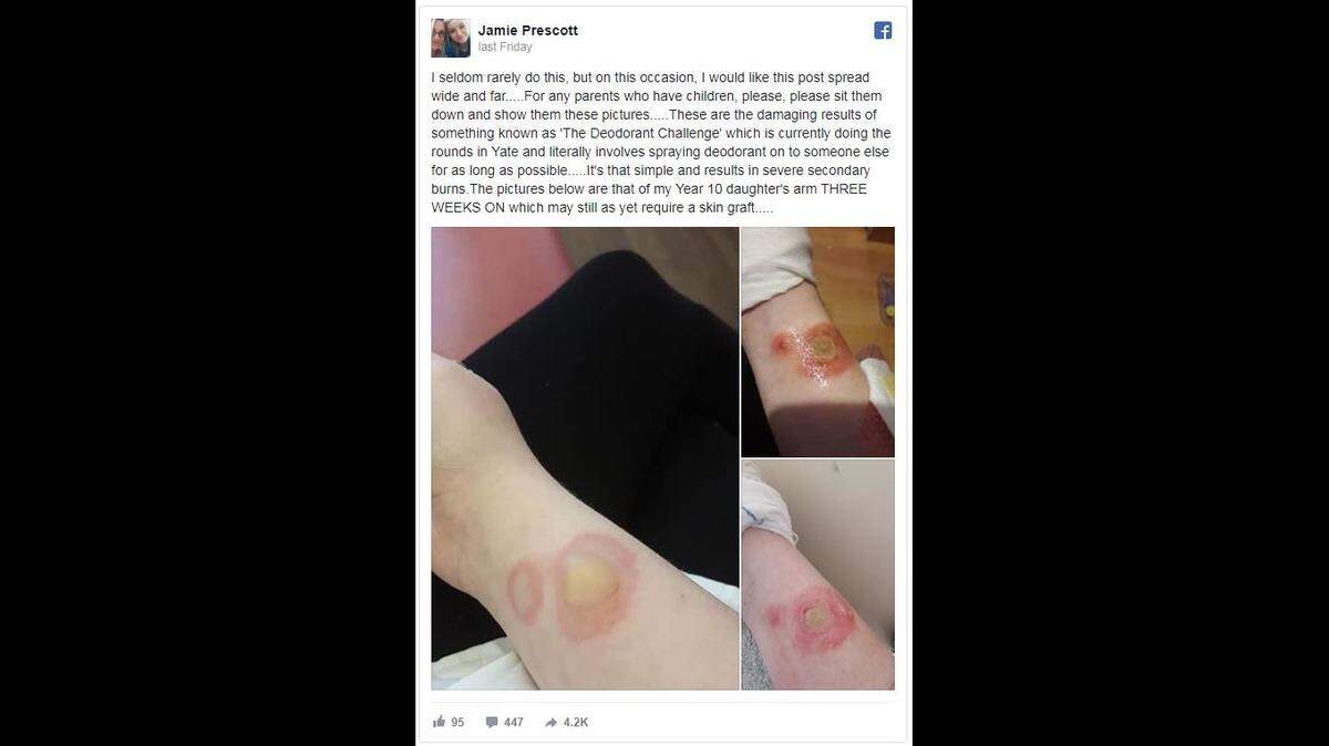 A Facebook post by a mom in England warning of the "deodorant challenge" has sounded the alarm about an online trend reportedly making the rounds.