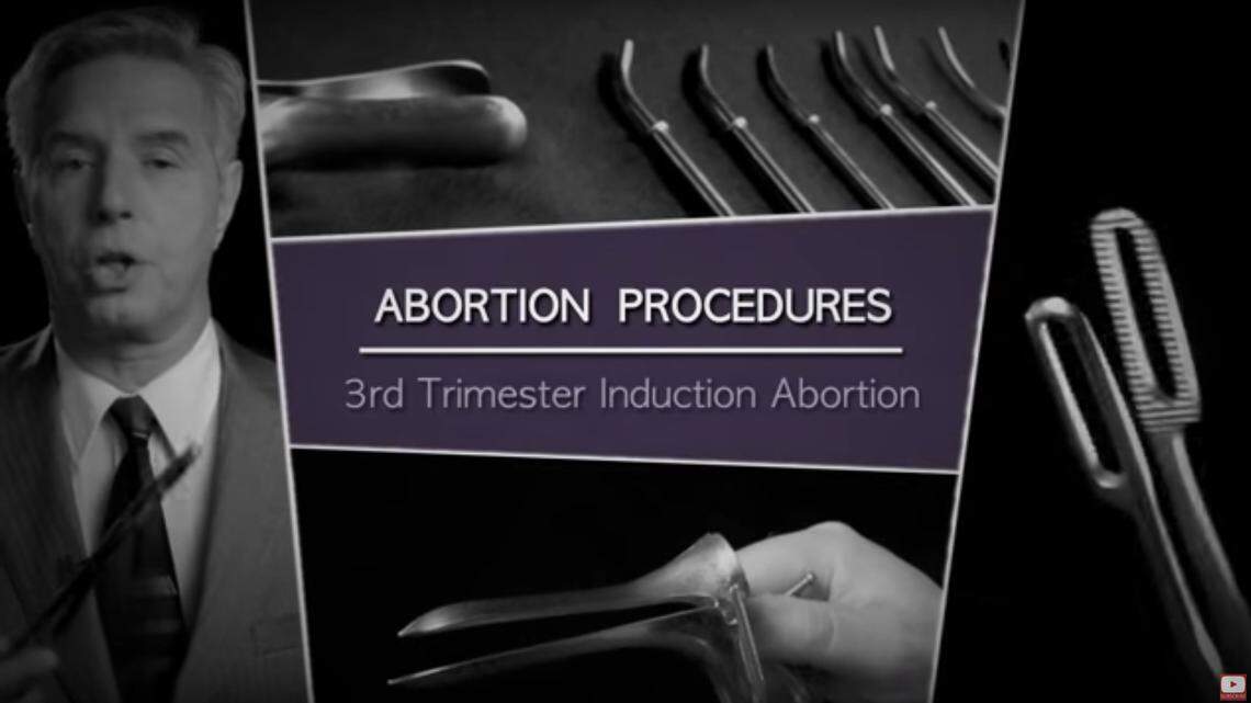 Anti-abortion activist Anthony Levatino appears in a frame grab from a video recently shown in a sex-education class at Sutter Middle School in Sacramento.