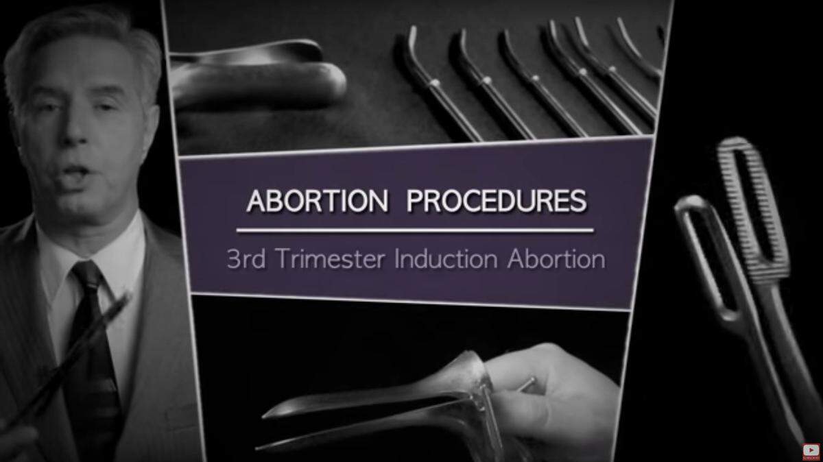 Anti-abortion activist Anthony Levatino appears in a frame grab from a video recently shown in a sex-education class at Sutter Middle School in Sacramento.