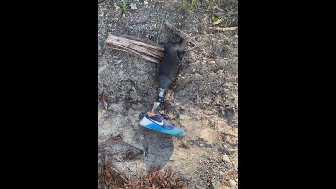 Skydiver Dion Calloway, 39, lost his leg following a skydiving accident two years ago, then Monday lost his prosthetic leg in another jump. The leg wound up in a lumber yard near the Sonoma County, California, airport.