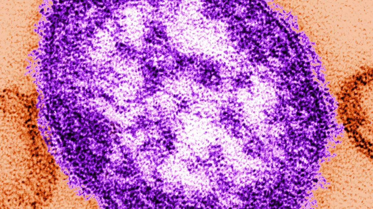 In a handout from the Centers for Disease Control and Prevention, a thin-section transmission electron micrograph shows the structural appearance of a single virus particle of measles.