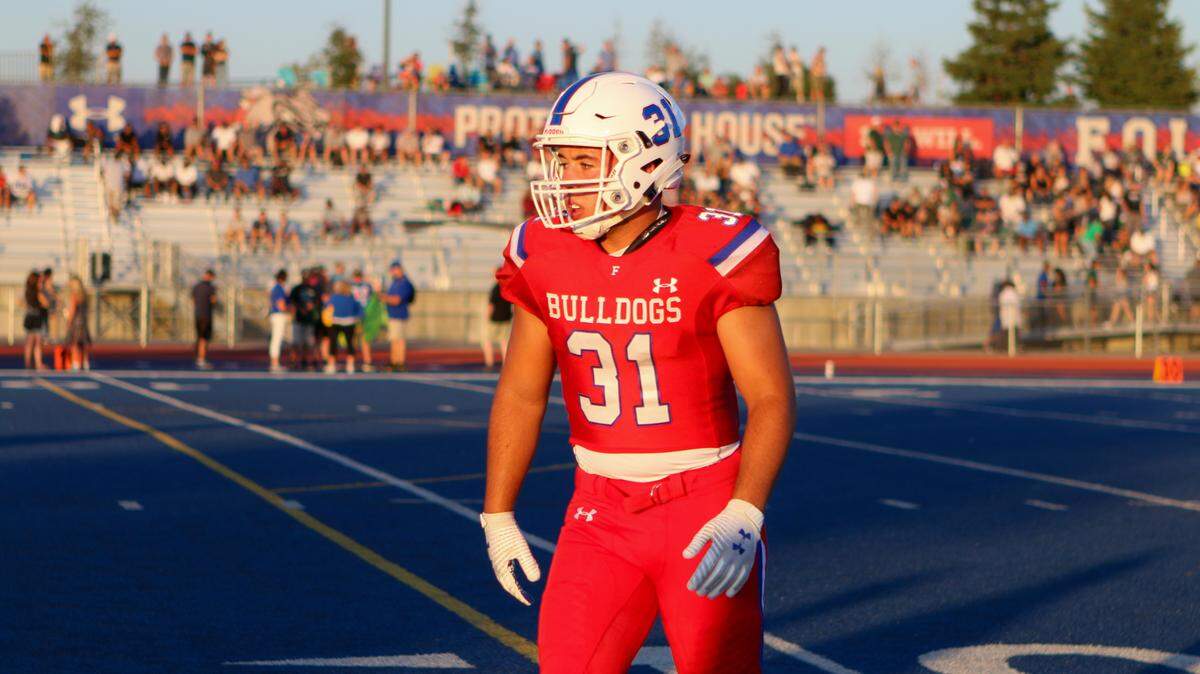 Dylan Richard fell off a skateboard while riding with some Folsom teammates in May.