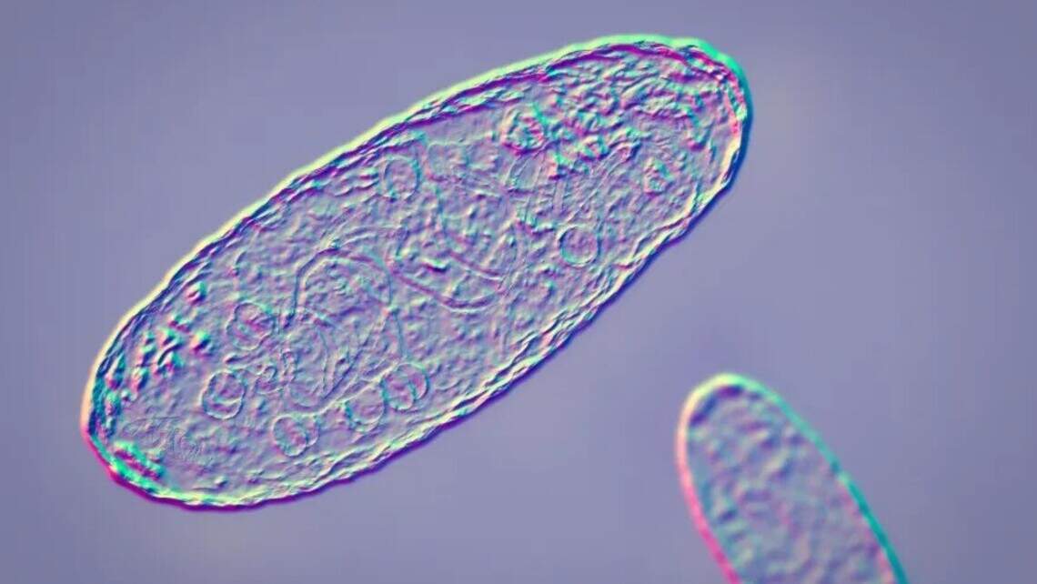 What is pneumonic plague? What to know as possible disease in Russia raises alarm