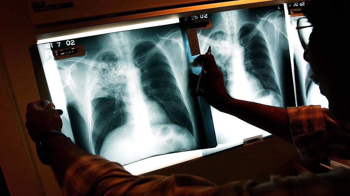 What New Science Says About Building Bone Density After 50, Including One Surprising Food That Helps