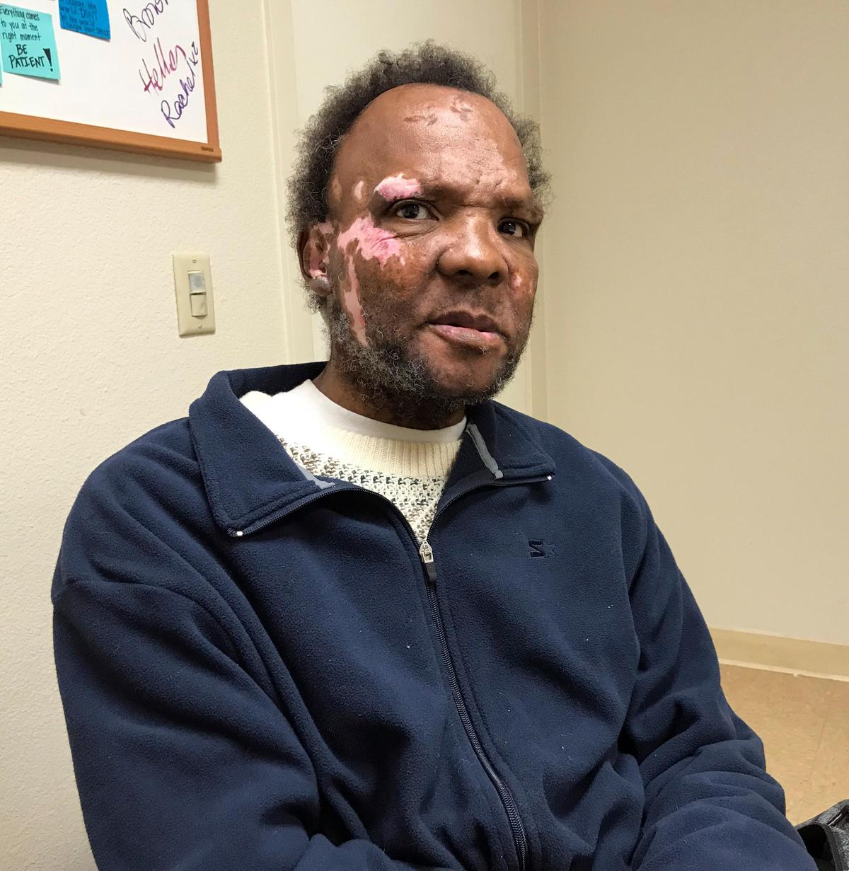 David Anthony Cook, 57, who is homeless, cycled through the UC Davis emergency room four times in less than four months. He is the type of patient that the new Whole Person Care program is targeting.