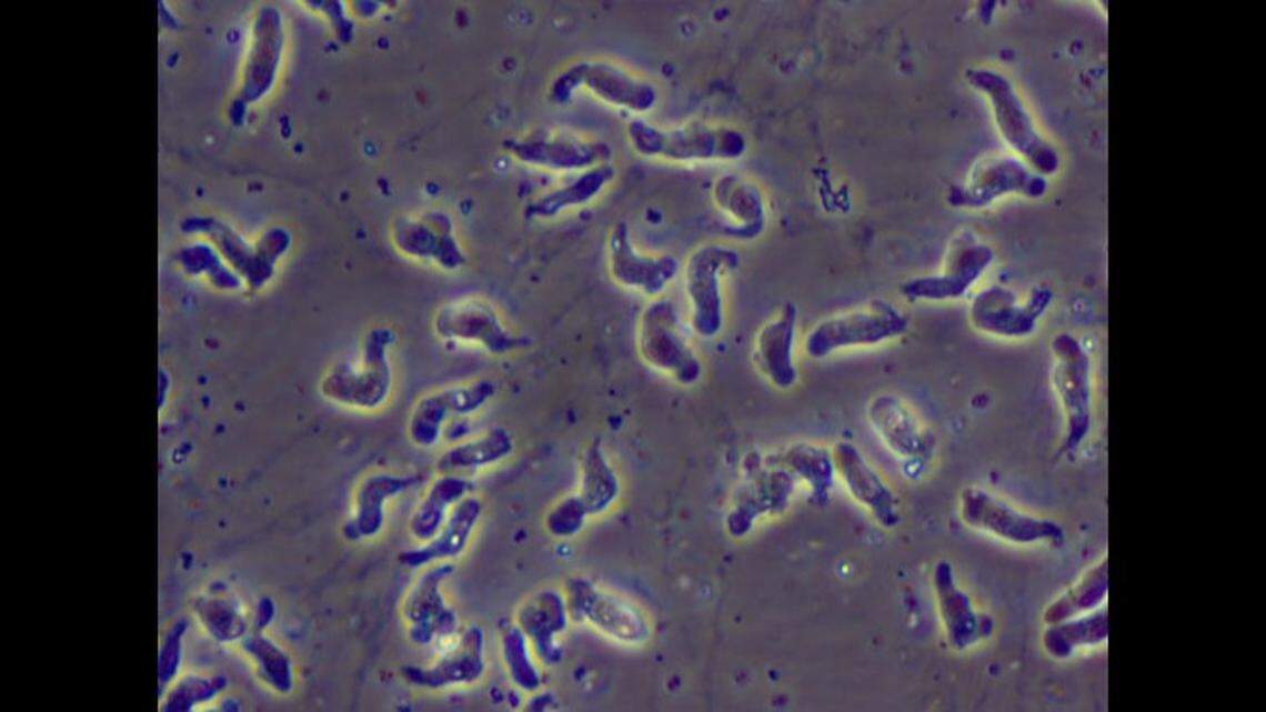 Naegleria fowleri seen under a microscope. A 2-year-old boy who visited a hot spring died of a brain-eating amoeba, Nevada health officials and the boy’s mother say.