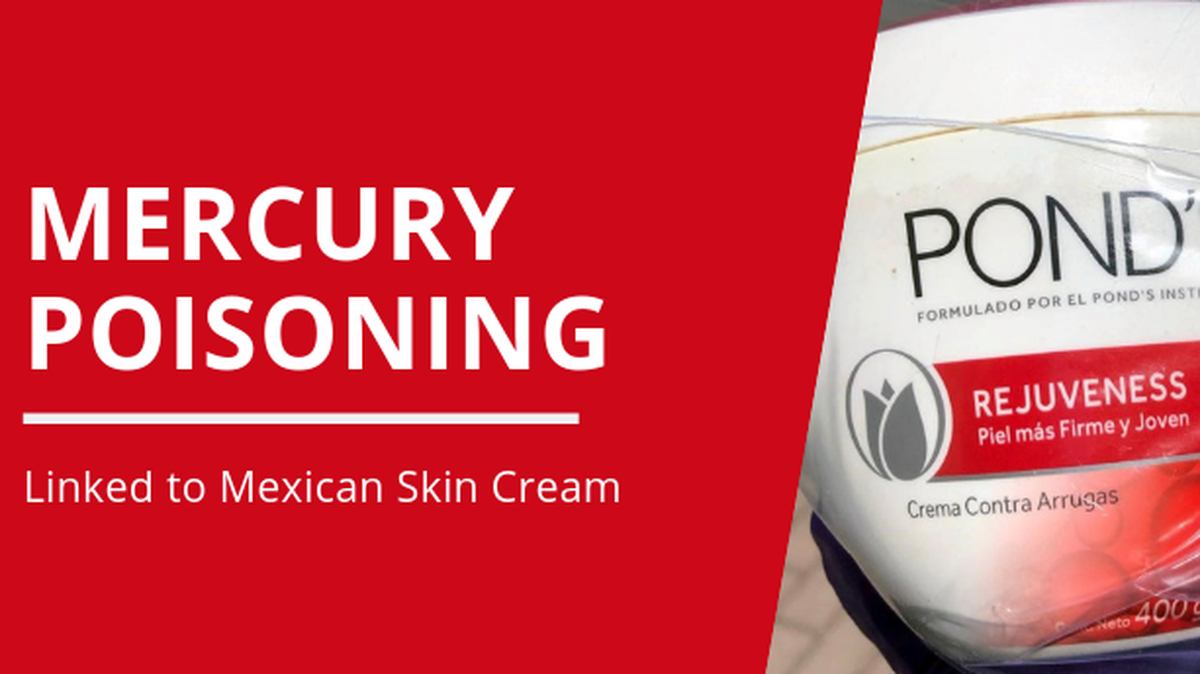 A Sacramento woman has been hospitalized for mercury poisoning and is in a “semi-comatose state” after using skin cream imported from Mexico that had mercury added by a third party, the county health department says.