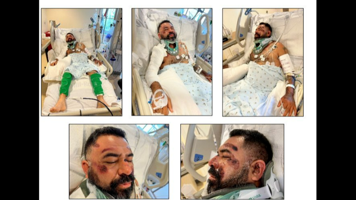 A man was severely injured when a van dragged him about 25 feet after he lost balance on an electric scooter and fell into the street, police in California said.