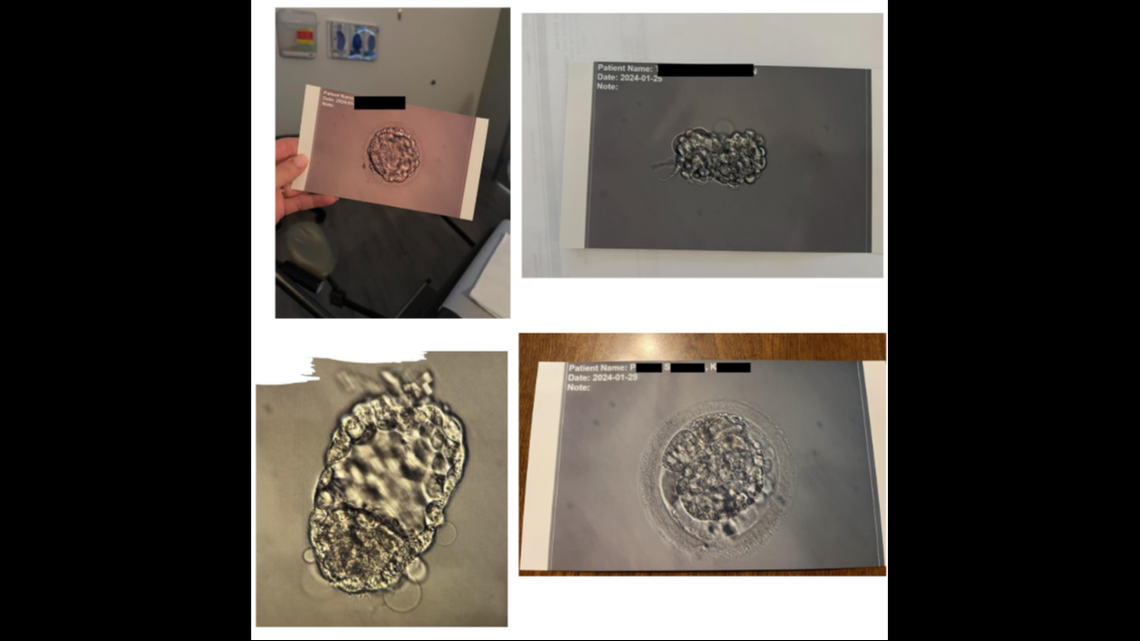 Photos of the plaintiffs’ embryos.