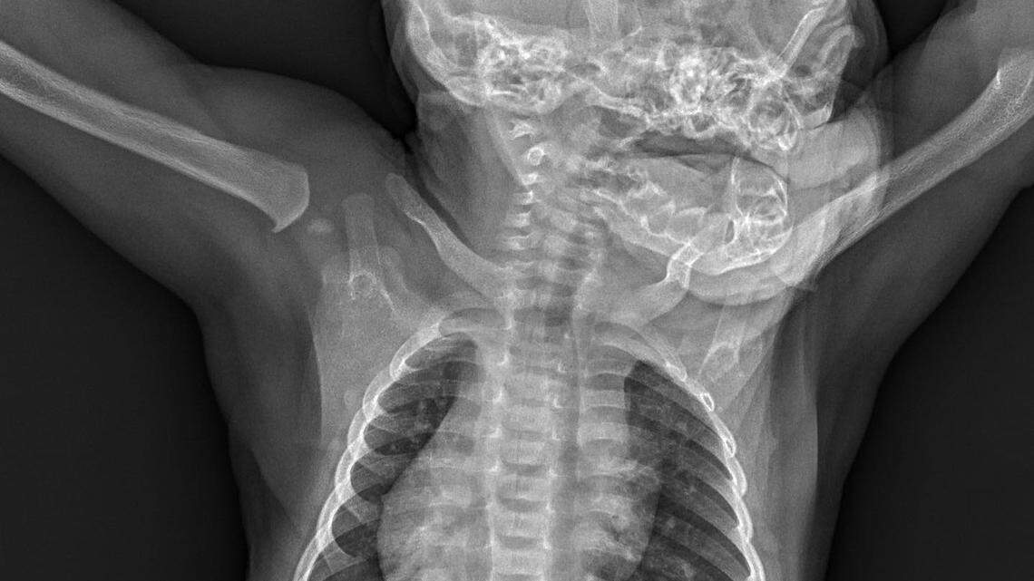 “Thanks for being transparent,” one person told the zoo in California.