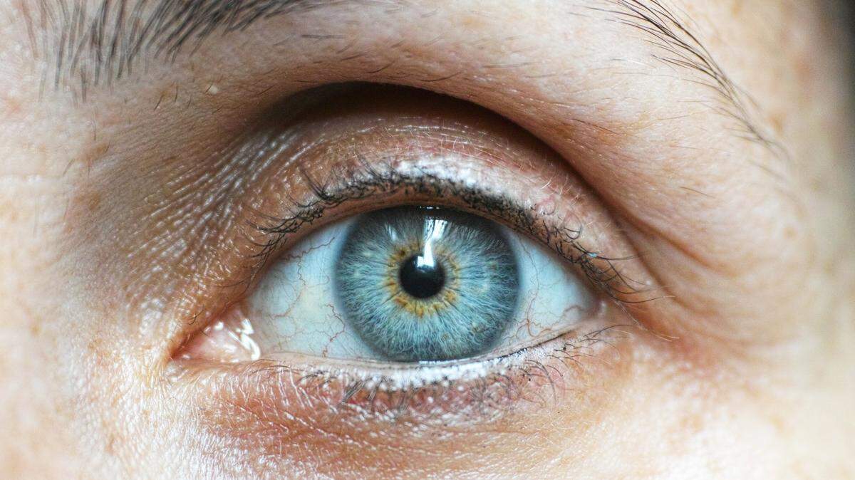 It had been “sitting under the eyelid for a month,” the doctor said.