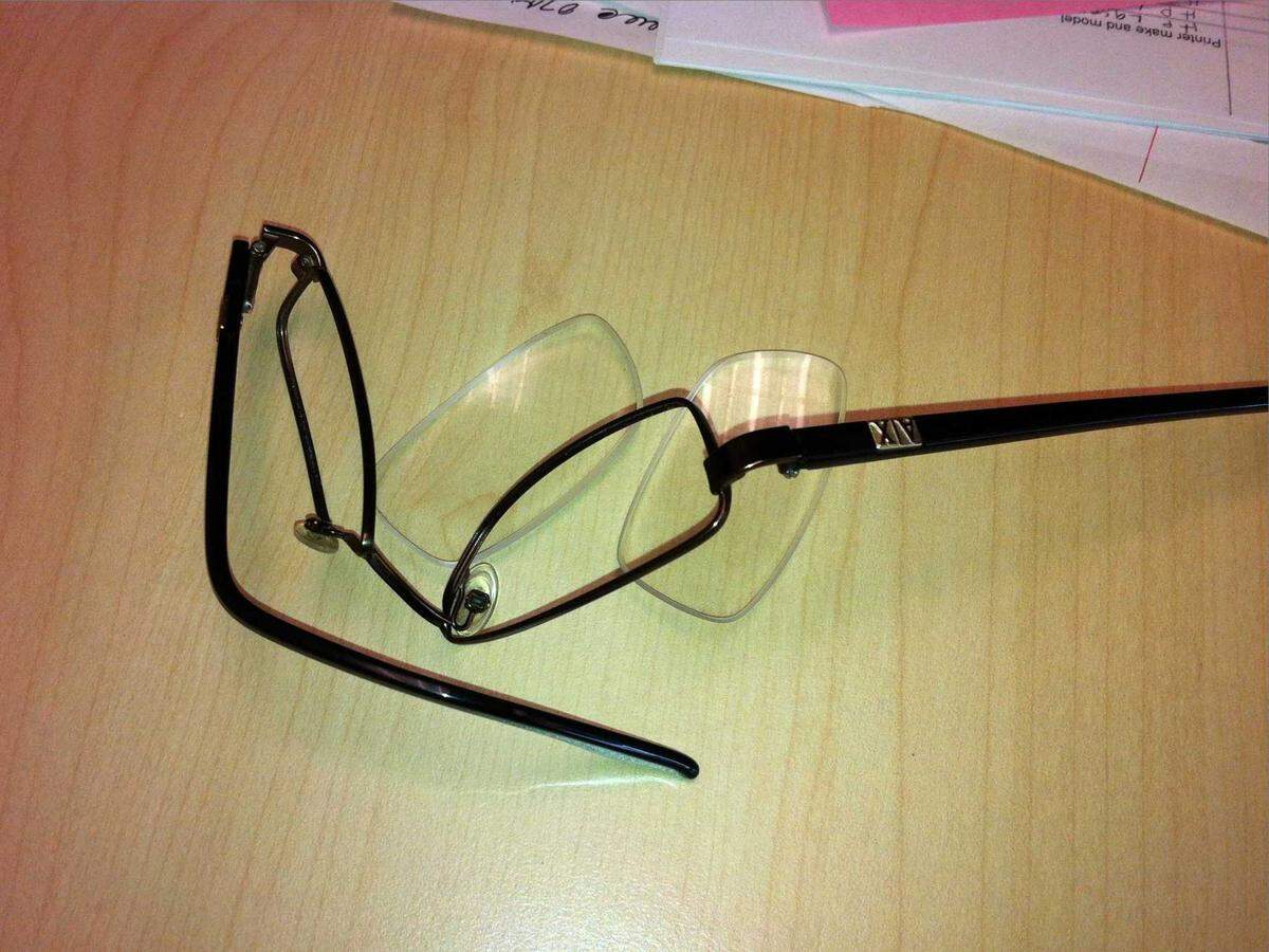 Emergency room nurse Michelle Ravera’s eyeglasses were broken by an agitated patient who punched her in the face. Ravera and hospital security guards at Sutter Medical Center in Sacramento subdued the patient so he couldn’t hurt anyone else.