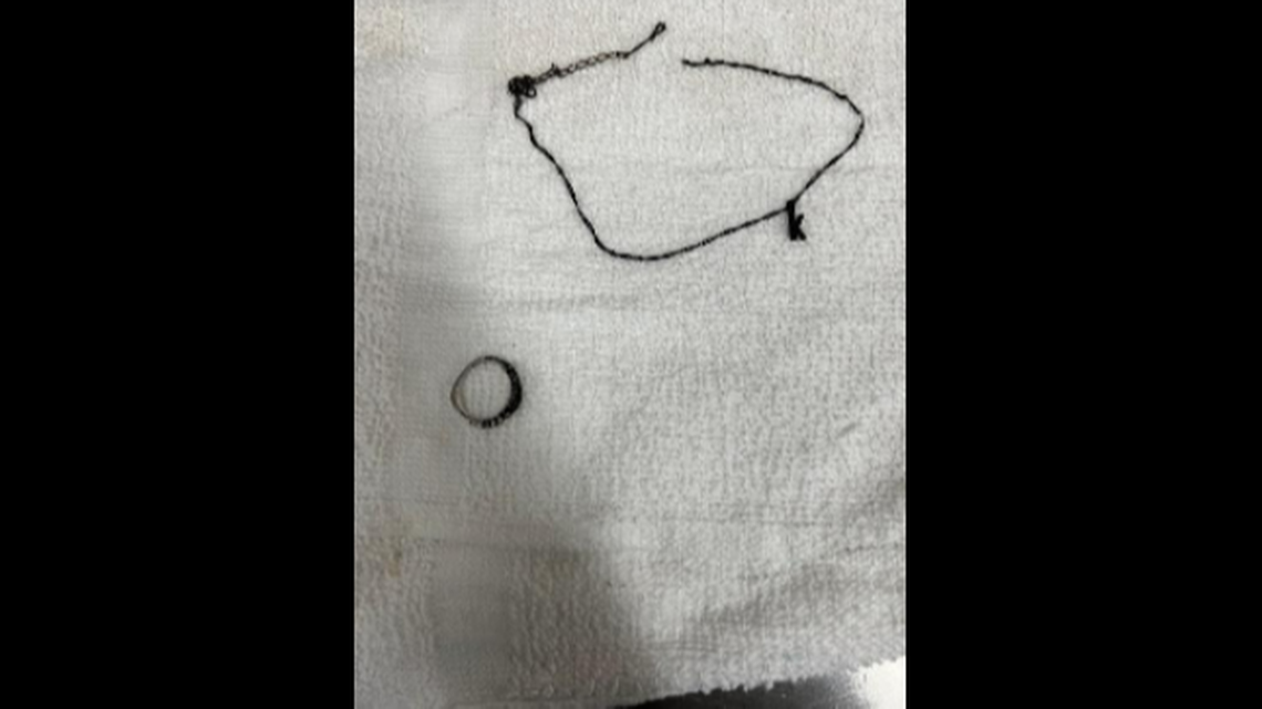 Police are trying to identify a woman through her jewelry after she was found set on fire in Antioch, California, on Oct. 17, 2022. A metal necklace with a pendant and a ring on her right ring finger were found on her body.
