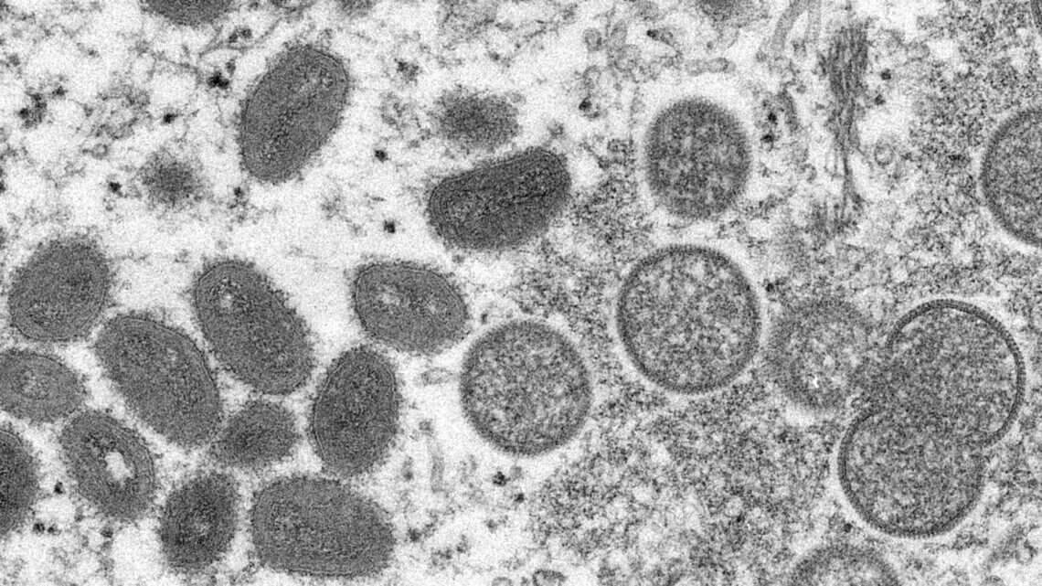 No confirmed cases of monkeypox in SC after people monitored in Midlands cleared by DHEC