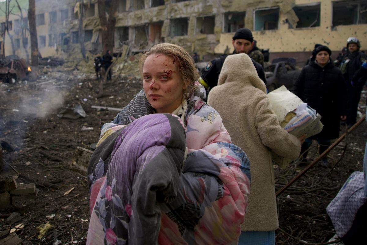 Mariana Vishegirskaya stands outside a maternity hospital that was damaged by shelling in Mariupol, Ukraine, on March 9. Visheirskaya was taken to another nearby hospital where she&nbsp;gave birth the following day to a baby girl she named Veronika. 