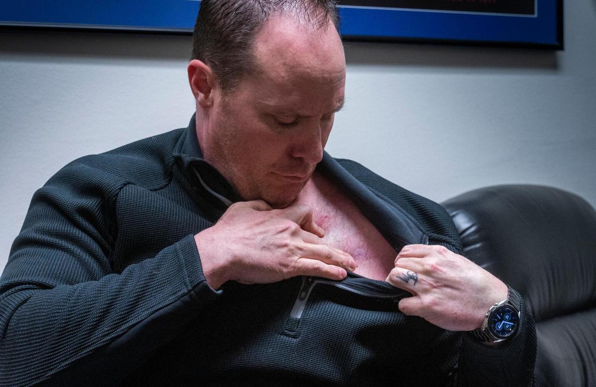 Trae deBeaubien shows where off-duty CHP Lt. Brad Wheat shot him in the chest. Two men then struggled over the handgun, but Wheat was able to elude deBeaubien's grasp.