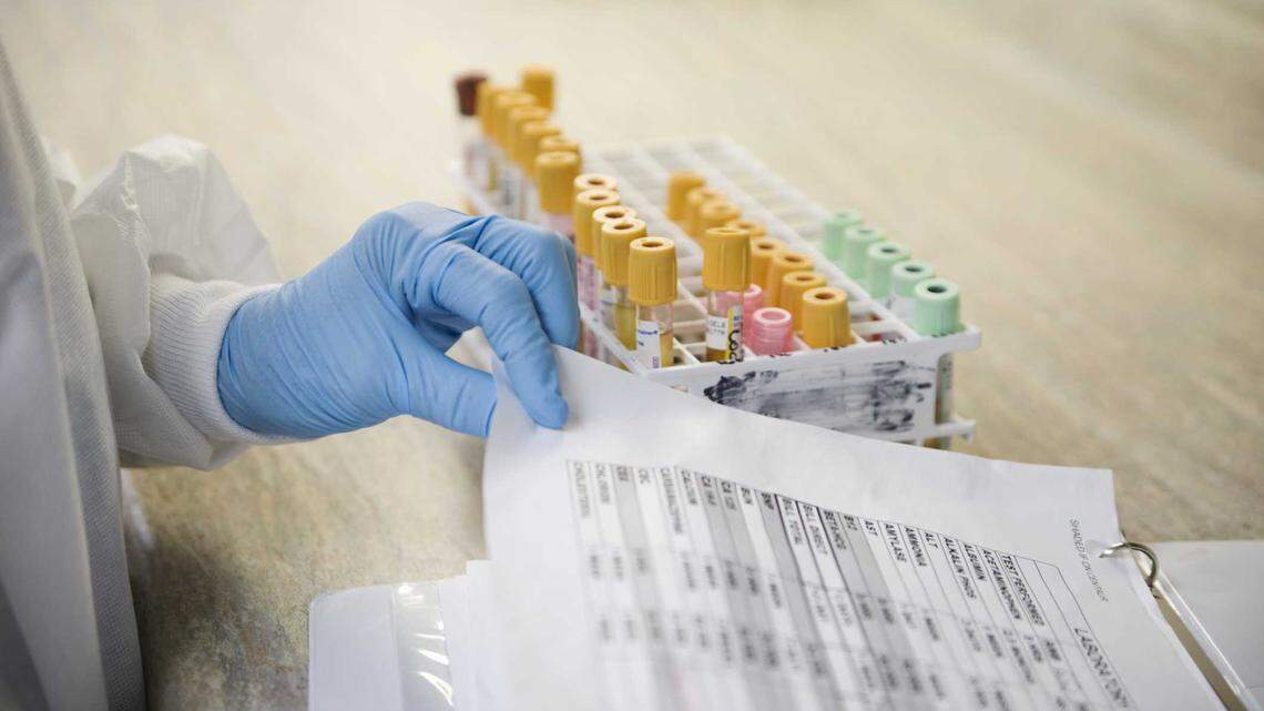 Proposed California bond measure would reverse federal research cuts | Opinion