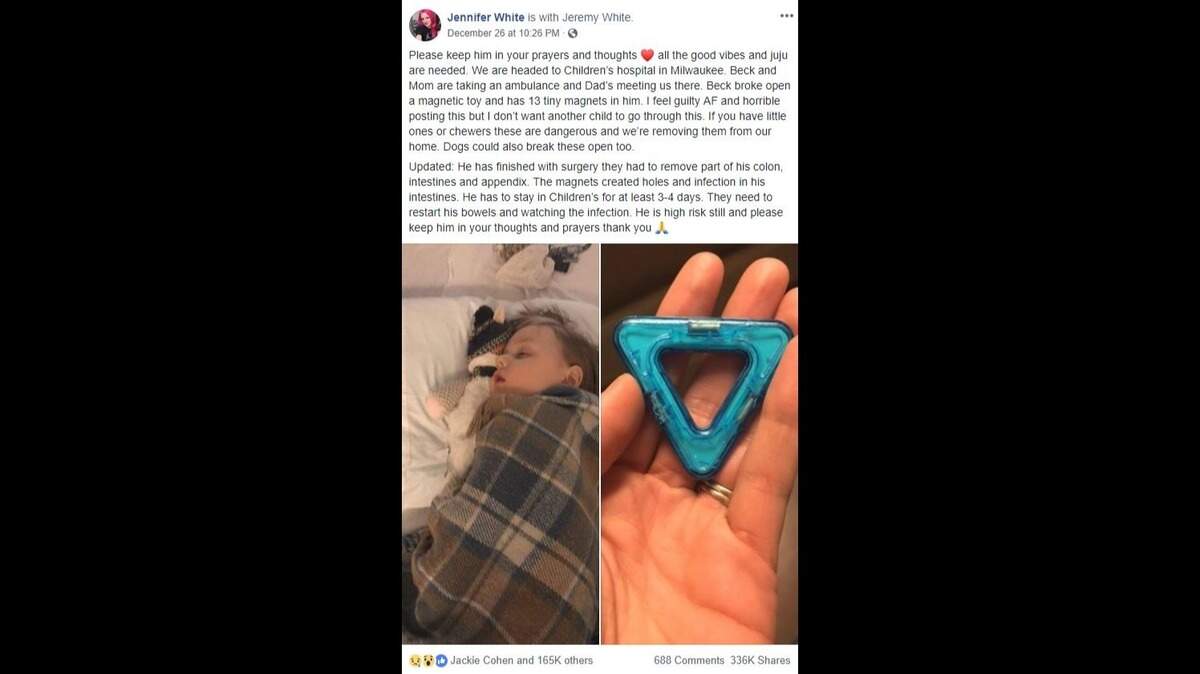Beck White, 4, required life-saving surgery to remove parts of his colon and intestines after he ate 13 toy magnets at Christmas, prompting his mother, Jennifer White of Wisconsin, to warn other parents.