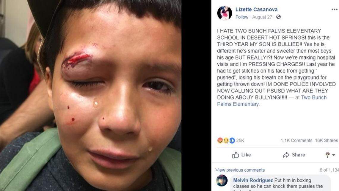 A bullied 10-year-old in Desert Hot Springs, California, says he refused to fight back despite being sent to the hospital because “it’s not the Jedi way.” Luke Skywalker actor Mark Hamill praised him on Twitter.