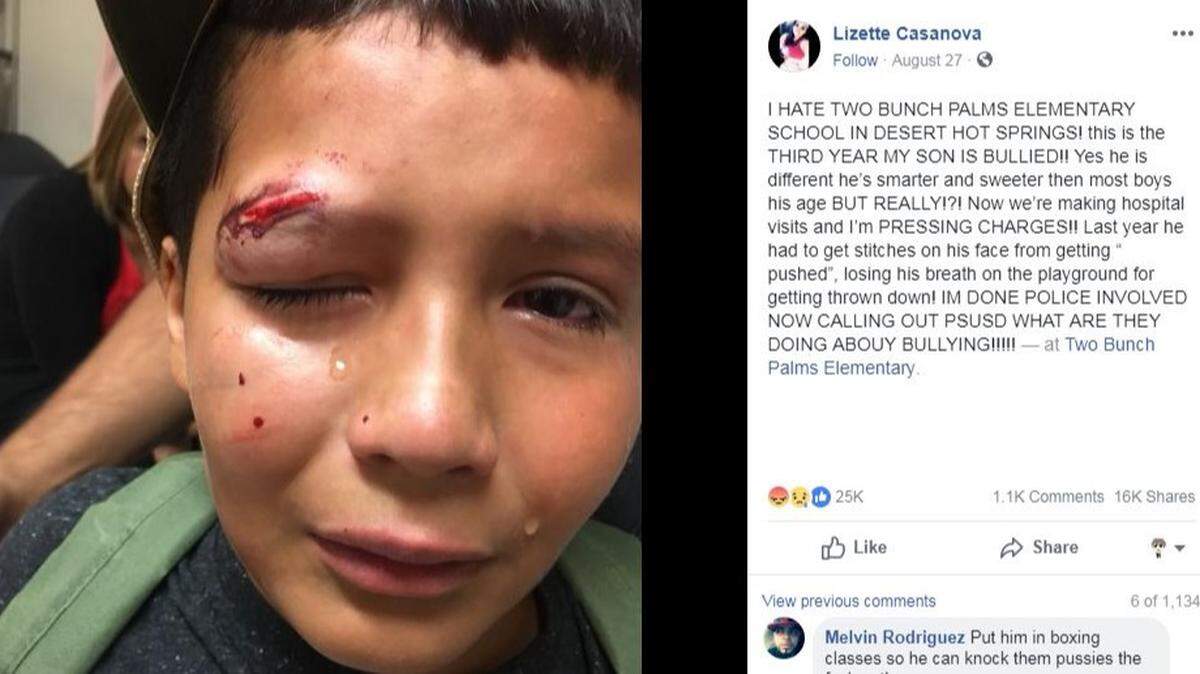 A bullied 10-year-old in Desert Hot Springs, California, says he refused to fight back despite being sent to the hospital because “it’s not the Jedi way.” Luke Skywalker actor Mark Hamill praised him on Twitter.