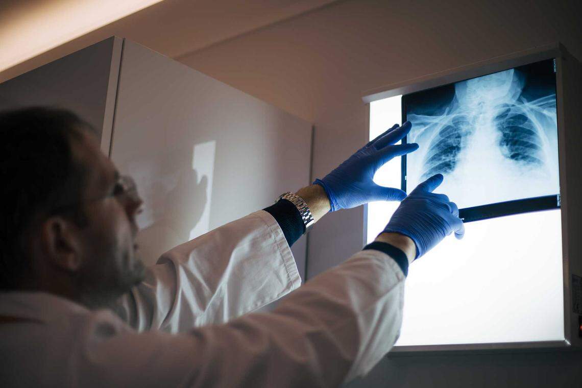 A physician looking at a chest X-ray in a doctor's office.