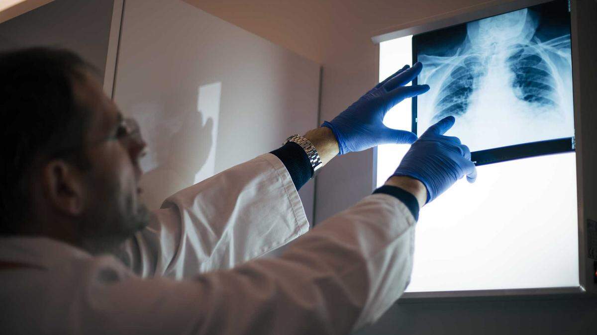 A physician looking at a chest X-ray in a doctor's office.