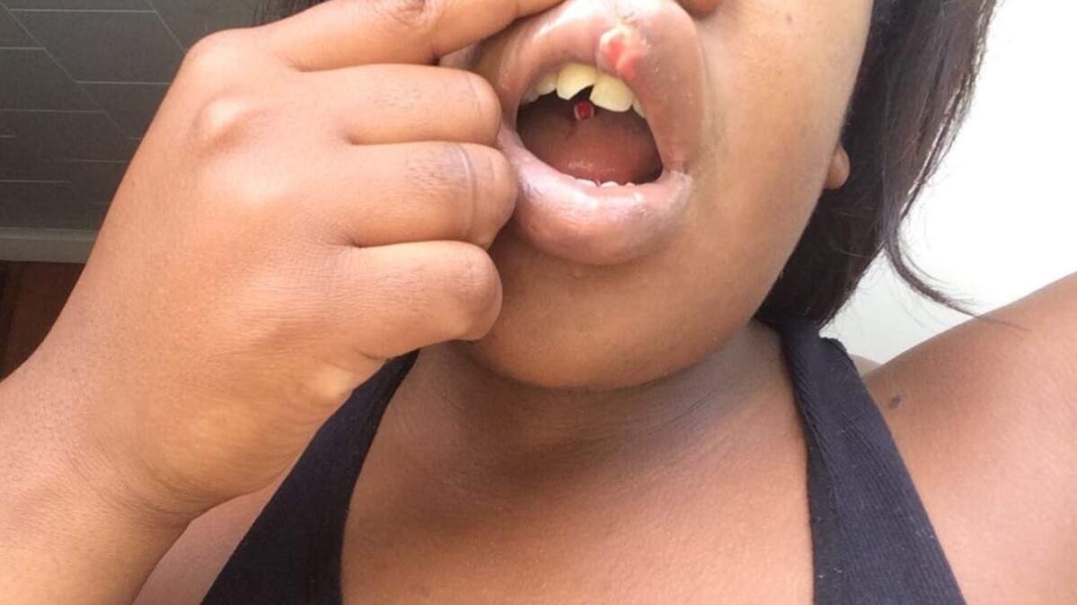Davisha Mitchell’s tooth was chipped after a Sacramento Sheriff’s deputy allegedly smashed her face against a wall while she was being booked at Sacramento County Main Jail, according to a federal lawsuit she filed last week.
