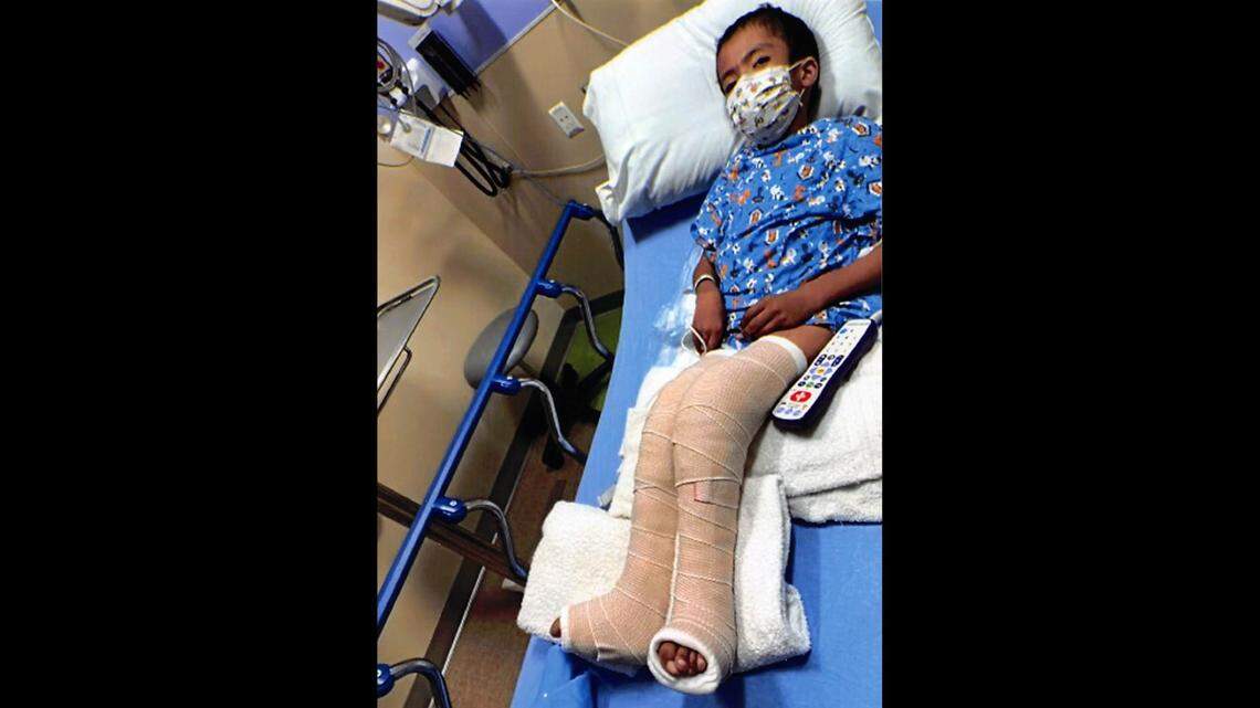 A child with disabilities broke his legs while using a wheelchair at Colorado school, and no one helped him, his mom’s lawsuit says.