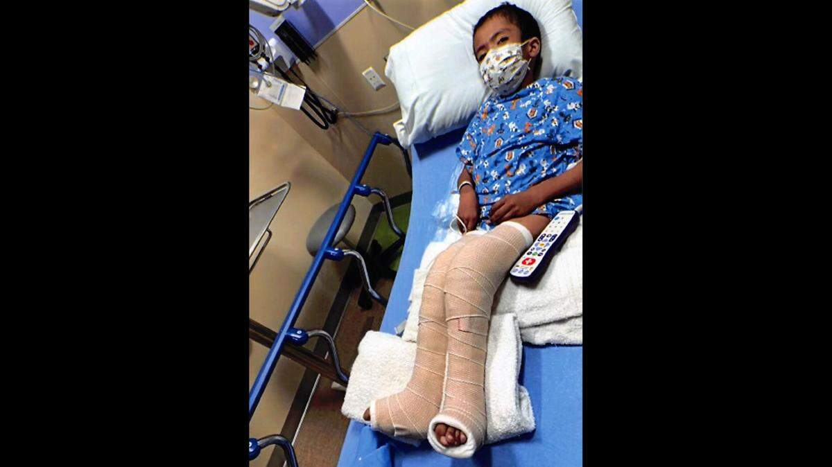 A child with disabilities broke his legs while using a wheelchair at Colorado school, and no one helped him, his mom’s lawsuit says.