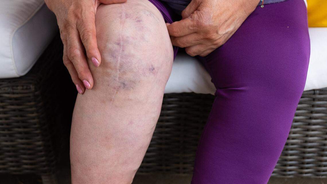 All immigrants need access to affordable health care. But how is that accomplished?