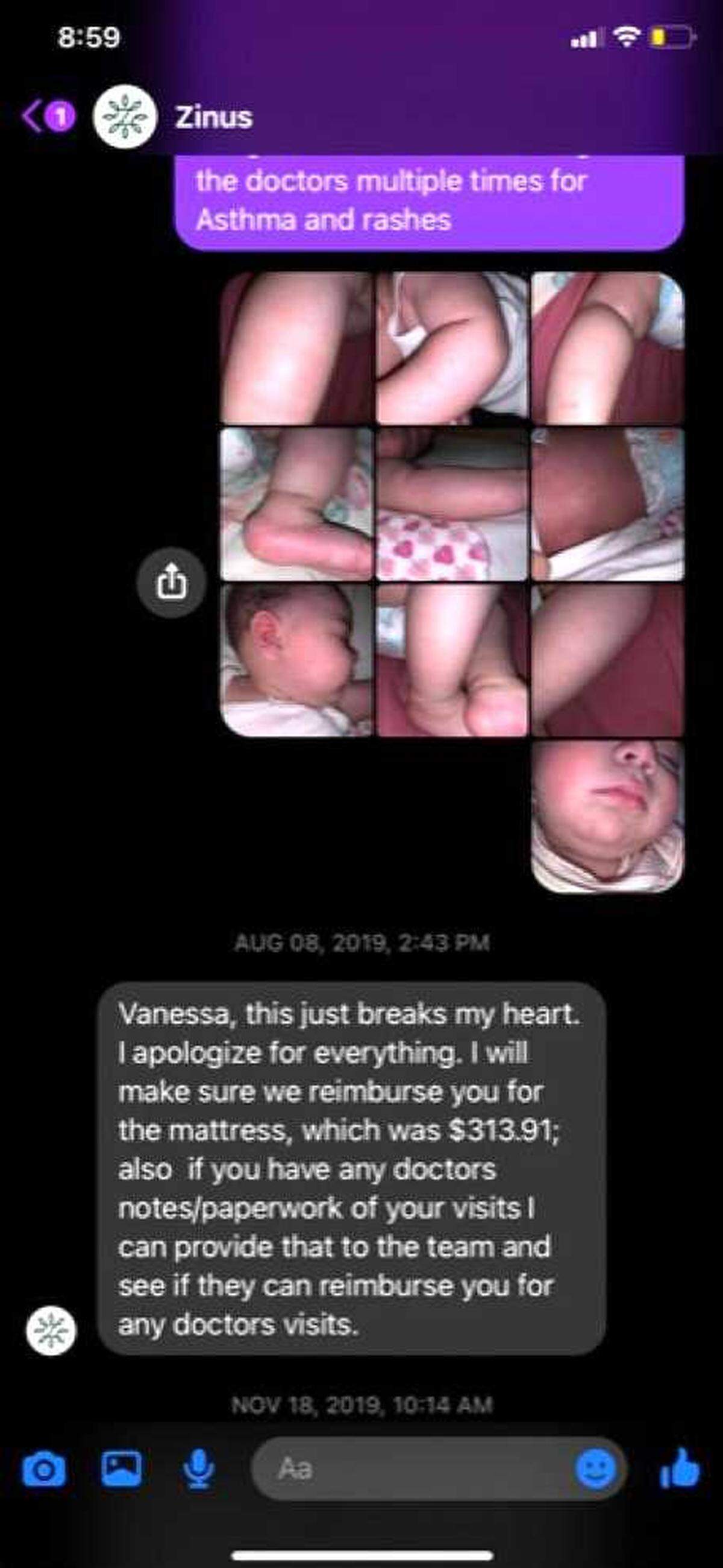 A screenshot from Vanessa Gutierrez shows photos of her infant child with rashes she says were caused by Zinus mattresses. The Sacramento mother is suing the maker of Zinus mattresses after she and her two children — one of them still an infant — were exposed to fiberglass.