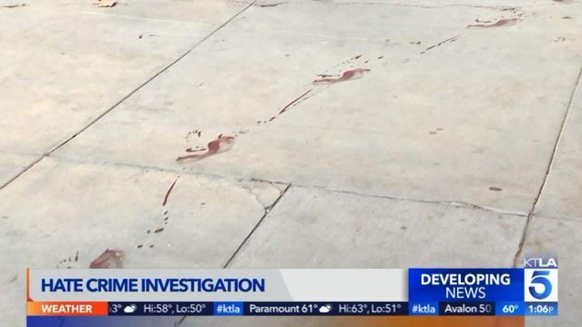 Los Angeles police are investigating swastikas drawn in blood inside a park restroom near the Museum of the Holocaust. A blood trail and bloody footprints also were left outside the restroom.