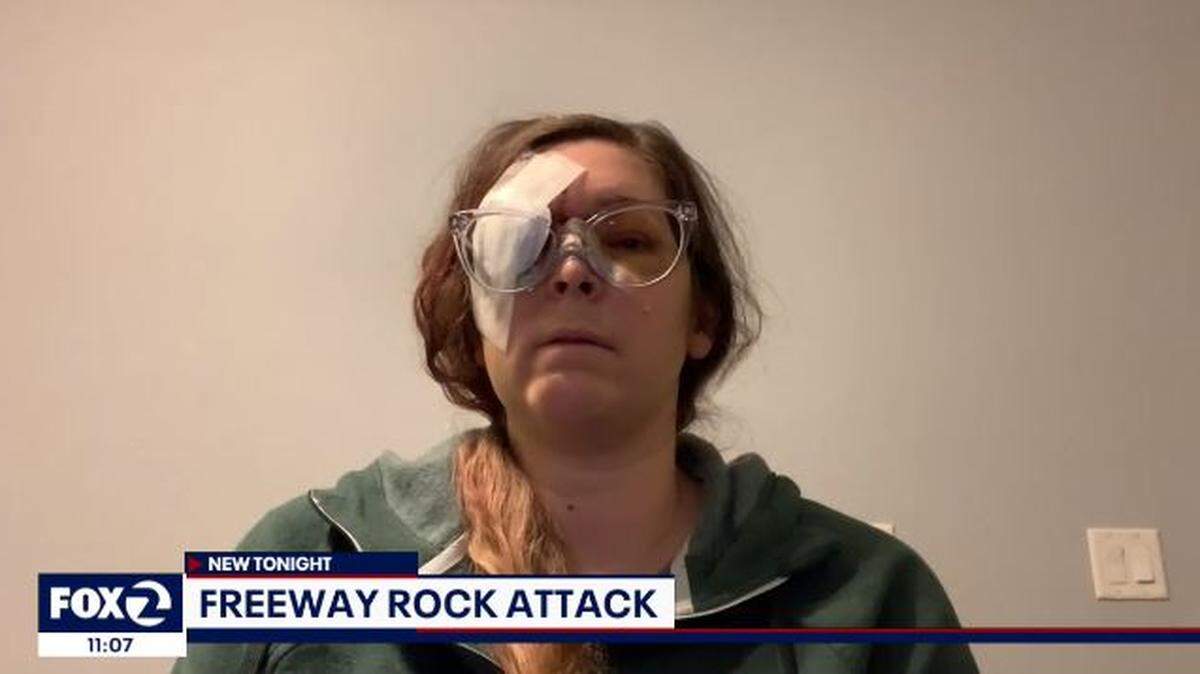 A Concord, California, nurse hit by a grapefruit-size rock thrown through her car windshield on her way to work fears she may lose her right eye.