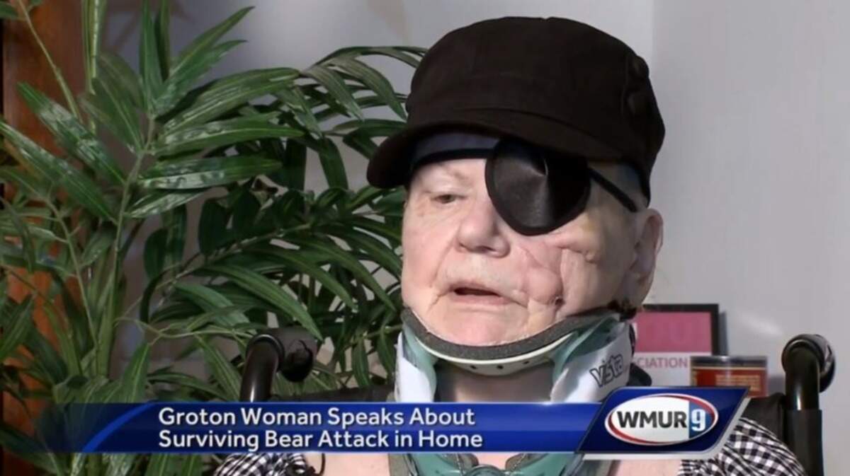Apryl Rogers, 71, lost her left eye when a bear ransacking the kitchen of her New Hampshire home mauled her July 17, but says she has no hard feelings toward the animal, which has not been found.