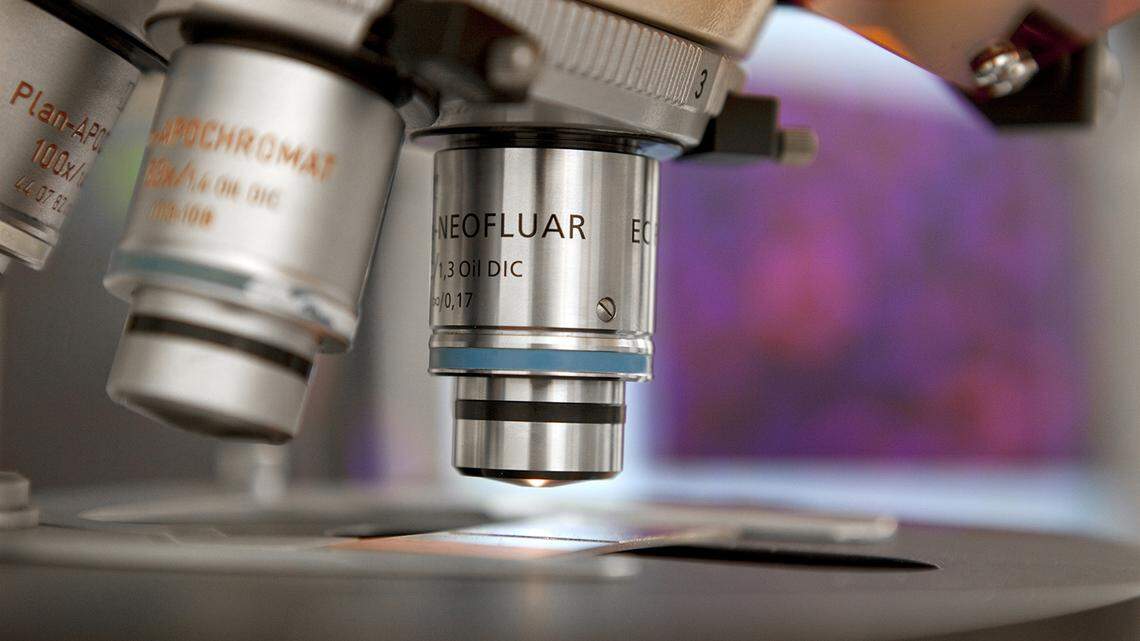 A deadly fungus outbreak has been confirmed in Washington. What to know about C. auris