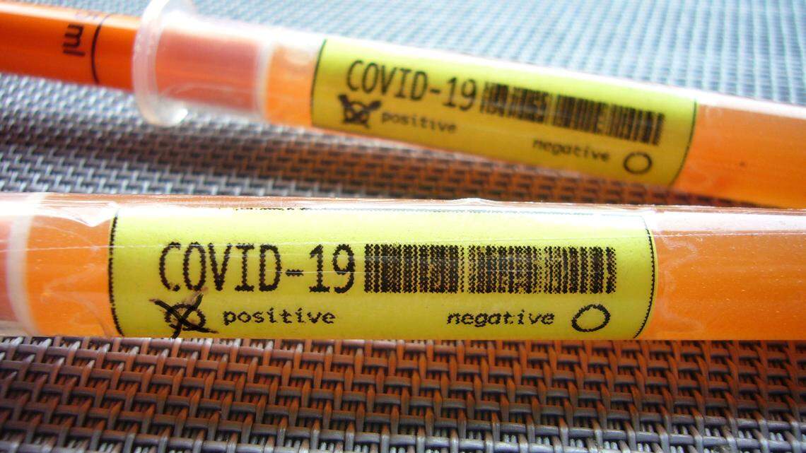 In almost all U.S. states, cases of infection have been confirmed with the new Coronavirus / Covid-19 (SARS-CoV-2).