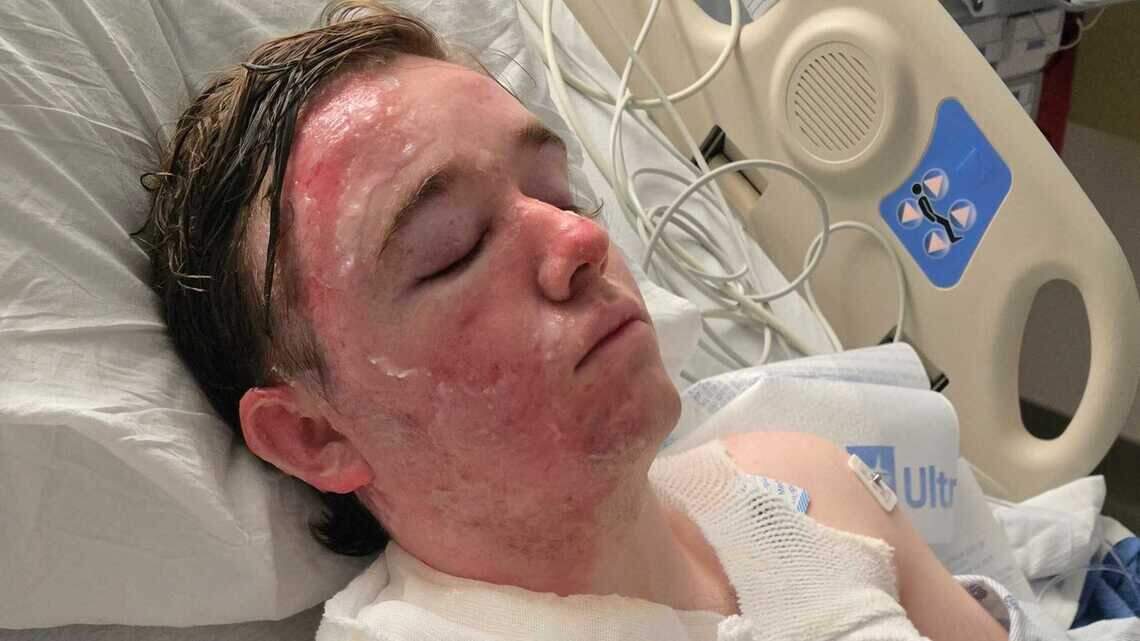 Yuba-Sutter McDonald’s worker burned in hot oil attack ‘blessed’ in hospital thank-you