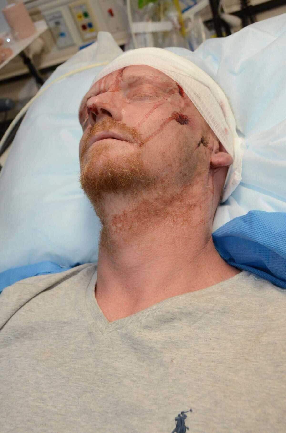 Larry Weigle is seen receiving care at Kaiser Permanente Medical Center, south Sacramento, following his arrest on Aug. 1, 2021. During the effort to restrain Weigle, who had run from police, a deputy stomped Weigle twice. Weigle is now suing the Sheriff’s Office as part of a federal civil rights lawsuit.