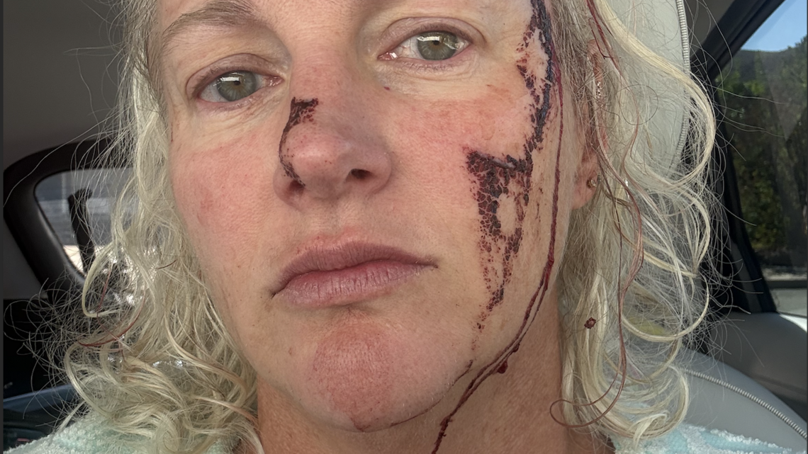 Lake Tahoe river otter attack leaves swimmer bloodied and needing 38 stitches