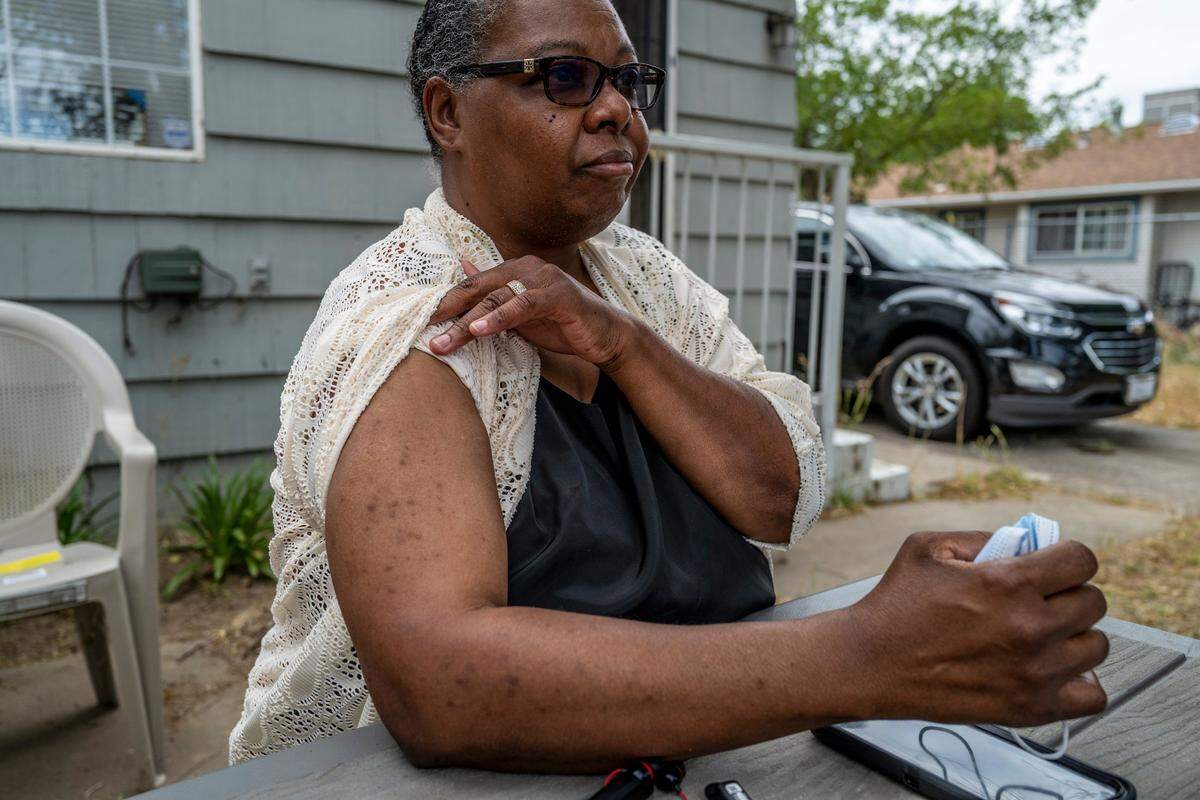 Lenora Jackson shows scars from bedbug bites earlier this month that she sustained in her rental house in South Oak Park. She has lived at the house since 2017, and believes her landlord wanted to use the pest issue as an excuse to kick her out and raise the rent on the property.